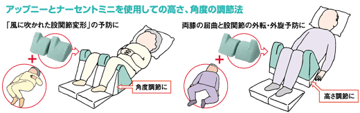床ずれ防止・両膝保持クッション・ナーセントアップニー
